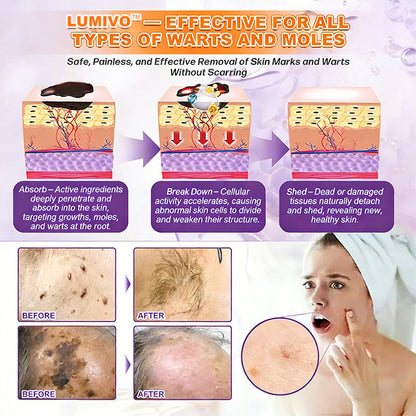 𝐔𝐒𝐀 𝐃𝐨𝐜𝐭𝐨𝐫 𝐑𝐞𝐜𝐨𝐦𝐦𝐞𝐧𝐝𝐞𝐝🌟|🔥LAST DAY 50% OFF - LUMIVO® Biotin 10-in-1 Skin Restoration Cream