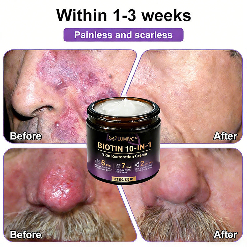 𝐔𝐒𝐀 𝐃𝐨𝐜𝐭𝐨𝐫 𝐑𝐞𝐜𝐨𝐦𝐦𝐞𝐧𝐝𝐞𝐝🌟|🔥LAST DAY 50% OFF - LUMIVO® Biotin 10-in-1 Skin Restoration Cream