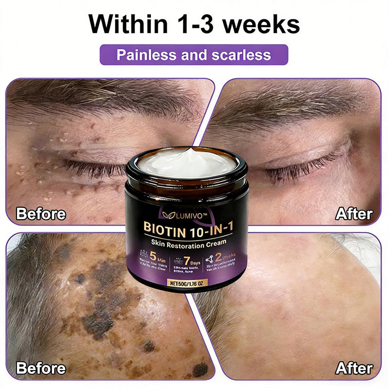 𝐔𝐒𝐀 𝐃𝐨𝐜𝐭𝐨𝐫 𝐑𝐞𝐜𝐨𝐦𝐦𝐞𝐧𝐝𝐞𝐝🌟|🔥LAST DAY 50% OFF - LUMIVO® Biotin 10-in-1 Skin Restoration Cream