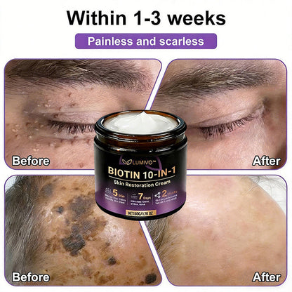 𝐔𝐒𝐀 𝐃𝐨𝐜𝐭𝐨𝐫 𝐑𝐞𝐜𝐨𝐦𝐦𝐞𝐧𝐝𝐞𝐝🌟|🔥LAST DAY 50% OFF - LUMIVO® Biotin 10-in-1 Skin Restoration Cream