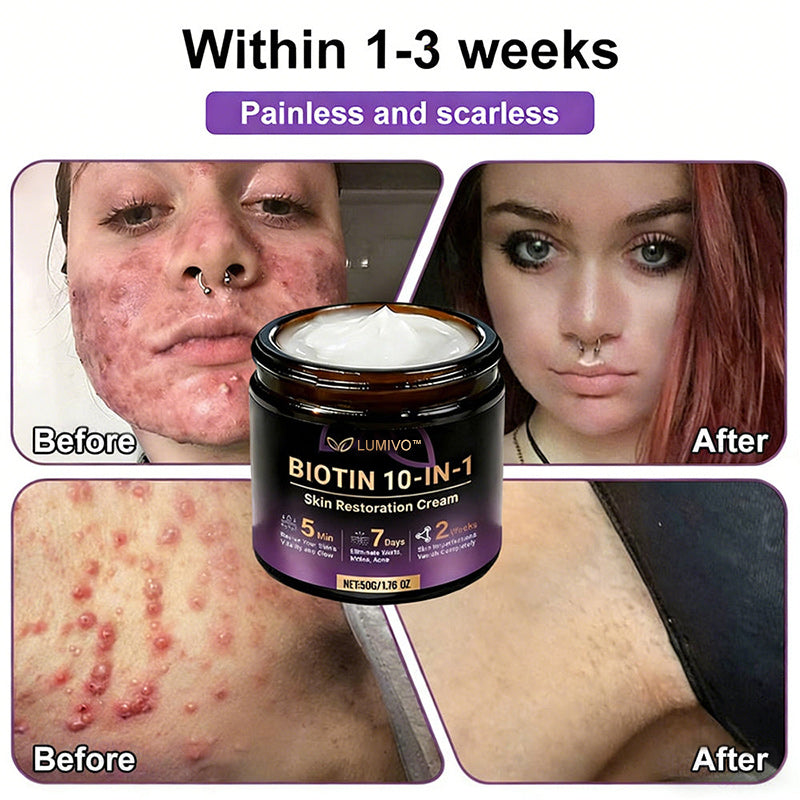 𝐔𝐒𝐀 𝐃𝐨𝐜𝐭𝐨𝐫 𝐑𝐞𝐜𝐨𝐦𝐦𝐞𝐧𝐝𝐞𝐝🌟|🔥LAST DAY 50% OFF - LUMIVO® Biotin 10-in-1 Skin Restoration Cream