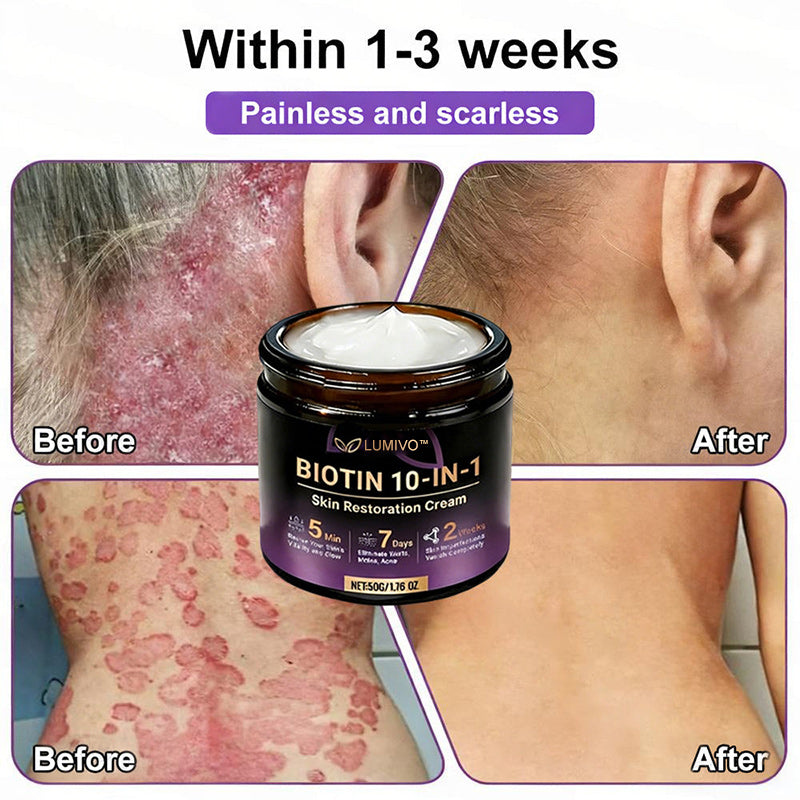 𝐔𝐒𝐀 𝐃𝐨𝐜𝐭𝐨𝐫 𝐑𝐞𝐜𝐨𝐦𝐦𝐞𝐧𝐝𝐞𝐝🌟|🔥LAST DAY 50% OFF - LUMIVO® Biotin 10-in-1 Skin Restoration Cream