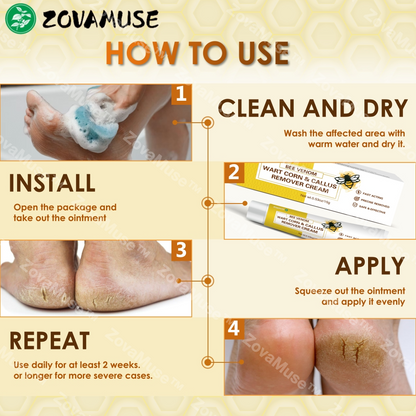 Bee Venom Corn & Callus Remover Cream