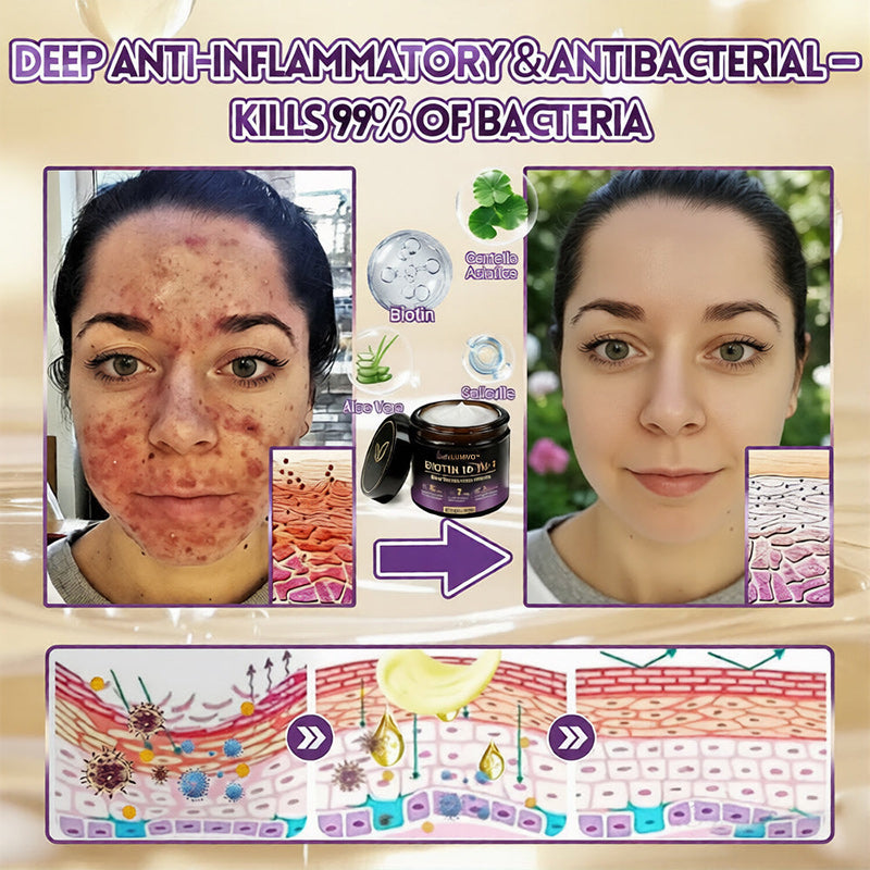 𝐔𝐒𝐀 𝐃𝐨𝐜𝐭𝐨𝐫 𝐑𝐞𝐜𝐨𝐦𝐦𝐞𝐧𝐝𝐞𝐝🌟|🔥LAST DAY 50% OFF - LUMIVO® Biotin 10-in-1 Skin Restoration Cream