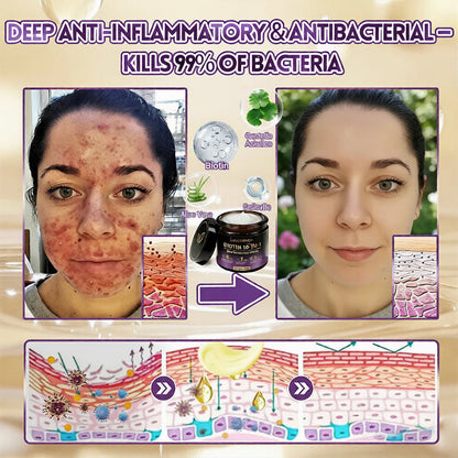 𝐔𝐒𝐀 𝐃𝐨𝐜𝐭𝐨𝐫 𝐑𝐞𝐜𝐨𝐦𝐦𝐞𝐧𝐝𝐞𝐝🌟|🔥LAST DAY 50% OFF - LUMIVO® Biotin 10-in-1 Skin Restoration Cream